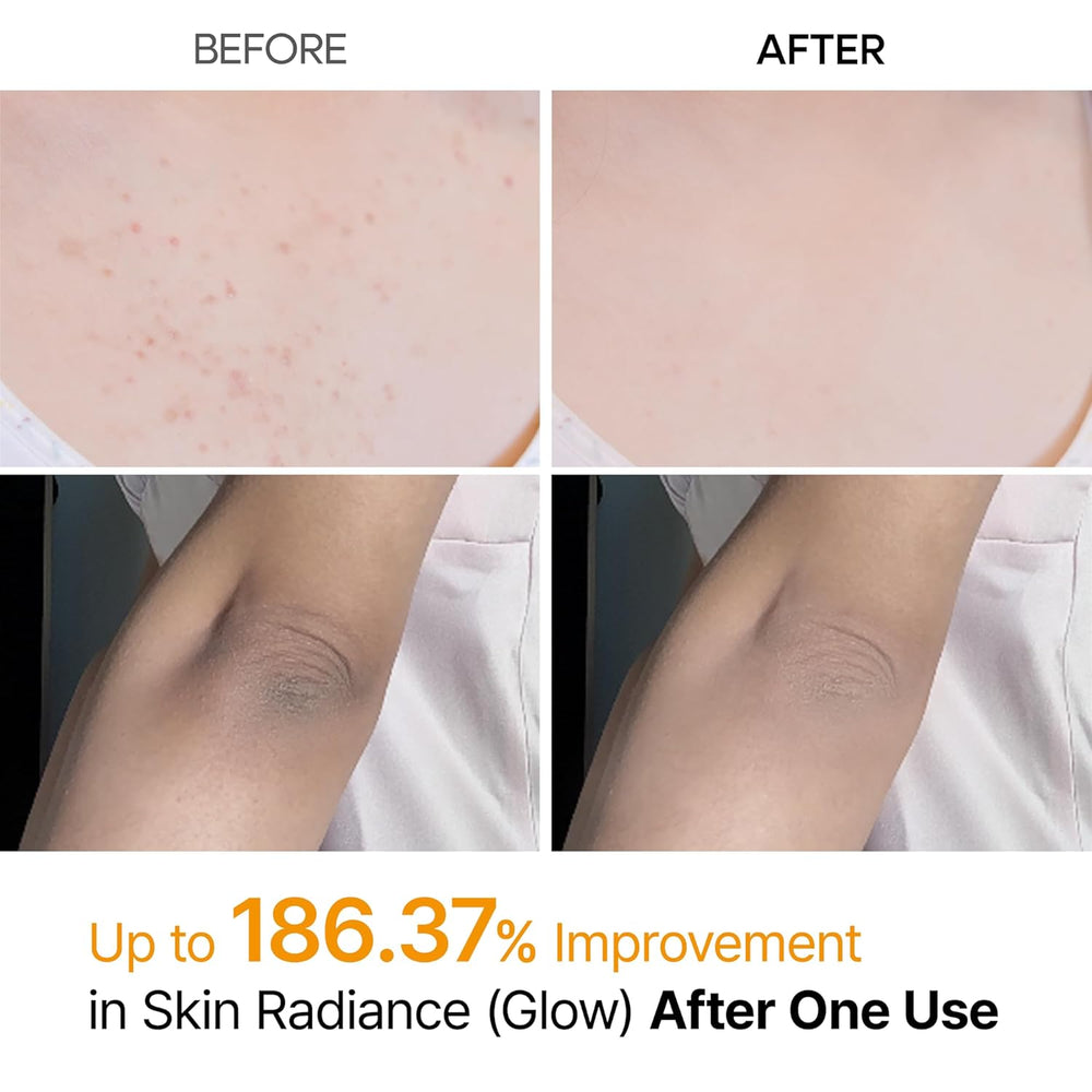 Dr.Melaxin Peel Shot Kojic Acid Spray